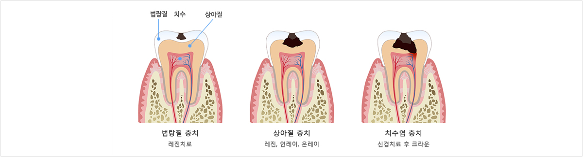 이미지명