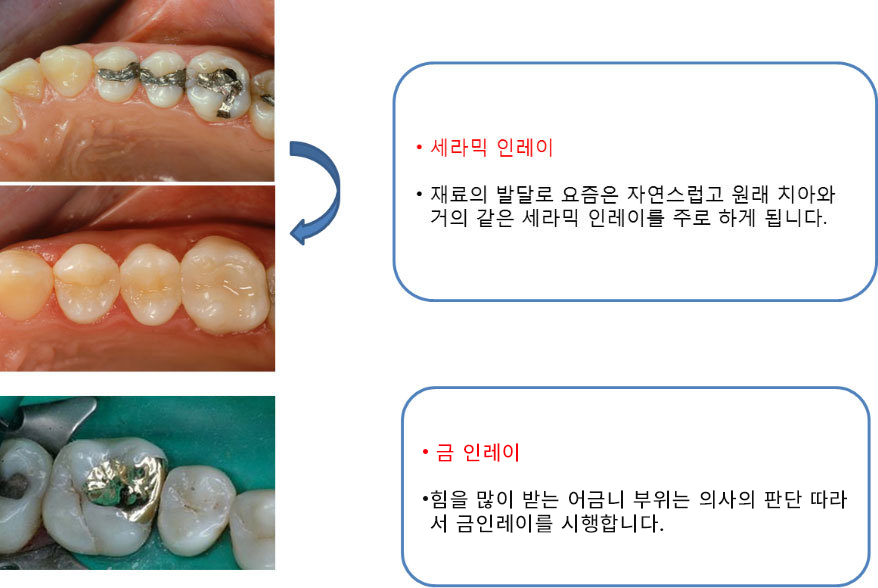 이미지명