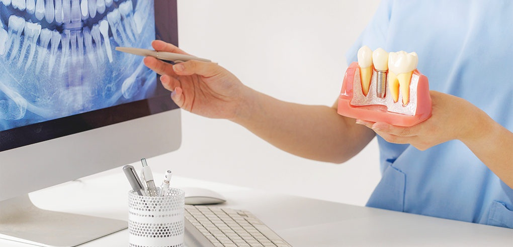 Dr. SONG DENTAL CLINIC|임플란트