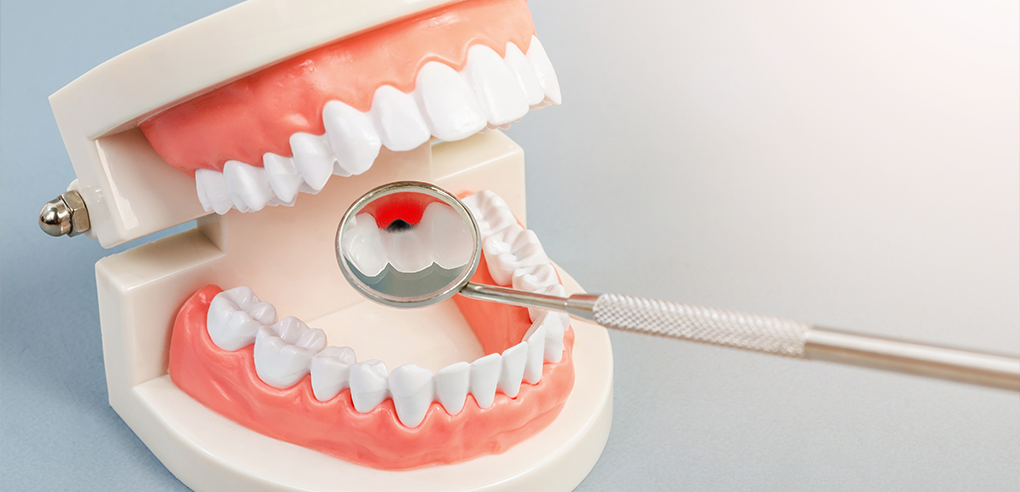 Dr. SONG DENTAL CLINIC|잇몸치료