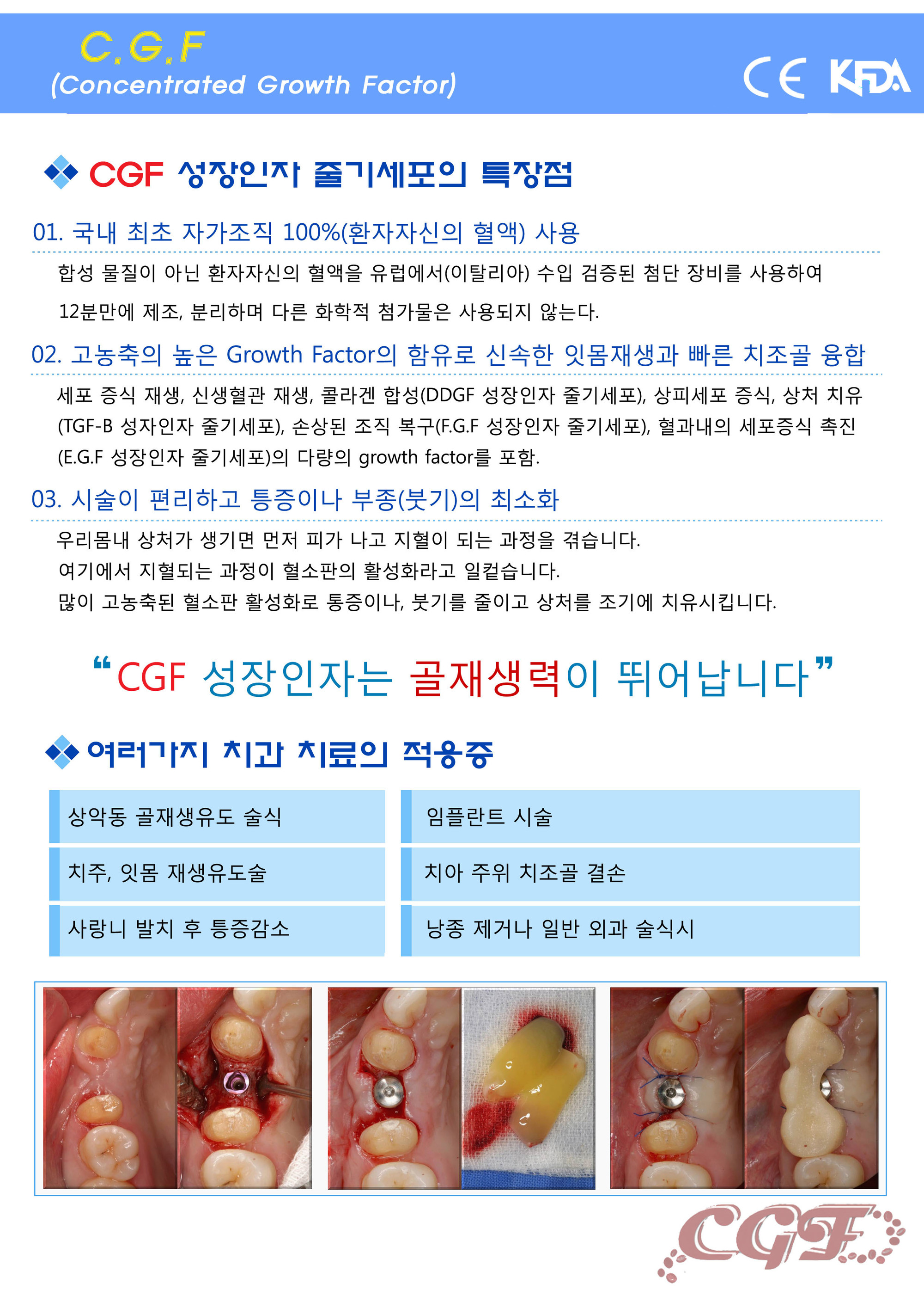 이미지명